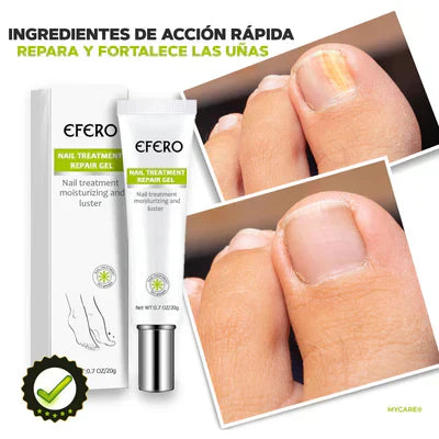 GEL ELIMINADOR DE HONGOS EN LOS PIES - MYCARE®